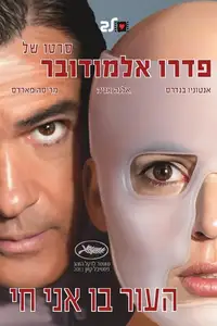 העור בו אני חי